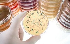 Diagnose parasitärer Krankheiten