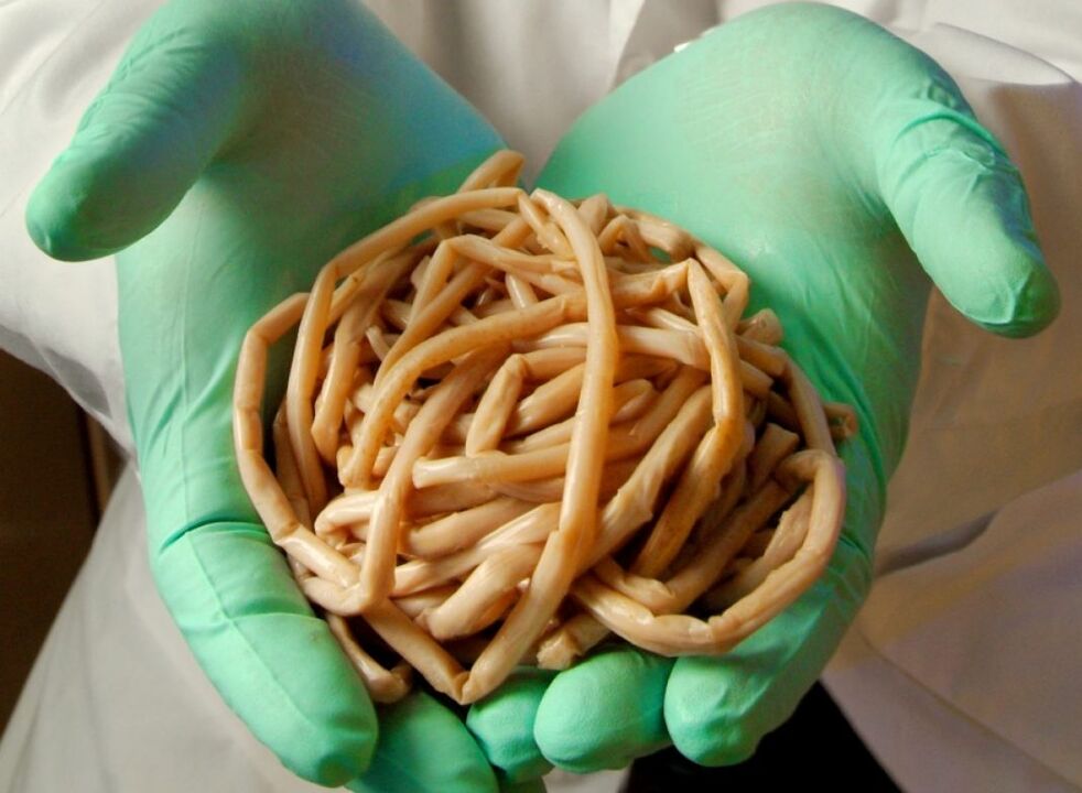 Was Parasiten haben Menschen
