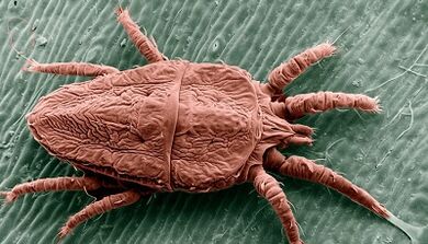 Methoden der parasitären Behandlung im Körper